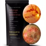 MEDECINE SCIENC Ophtalmologie Médecine interne Livre-0